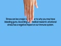 Important Tips to Prevent Bleeding Gums